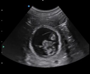 Cat pregnancy scan